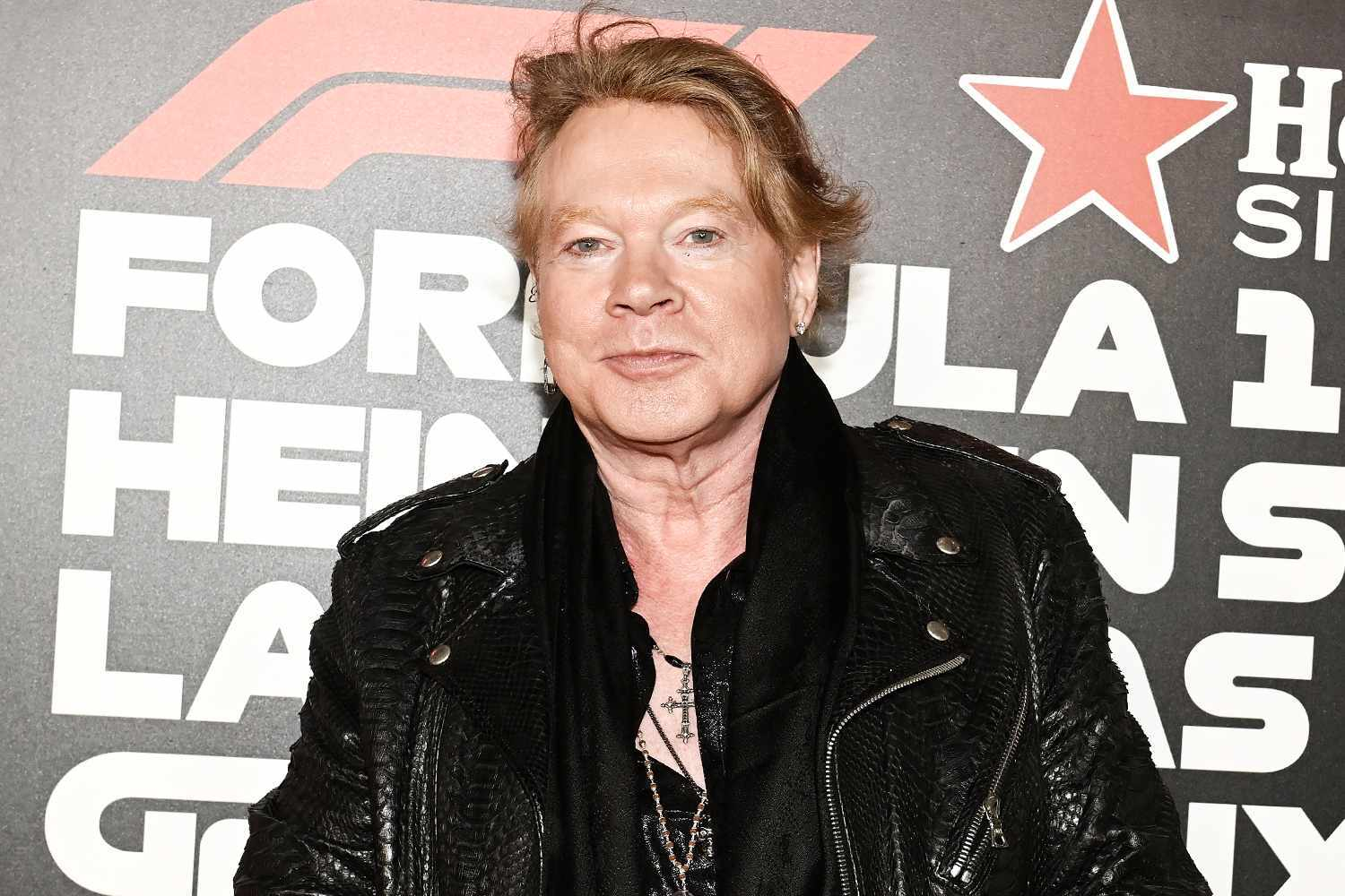 Axl Rose Reveals Jaw Trouble Onstage — Left Side Still Numb After Procedure